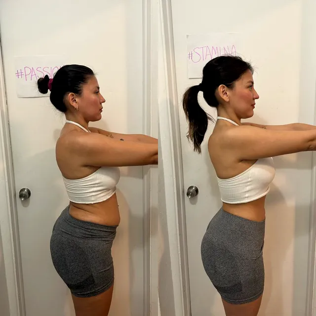 Stefania: antes y después de su proceso con Team Diamond